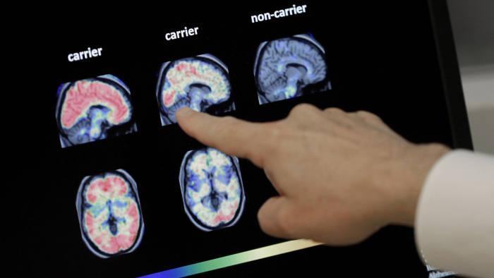 Roche’s alzheimer’s drug clears plaques in 28 weeks, faces 2028 test to slow memory loss