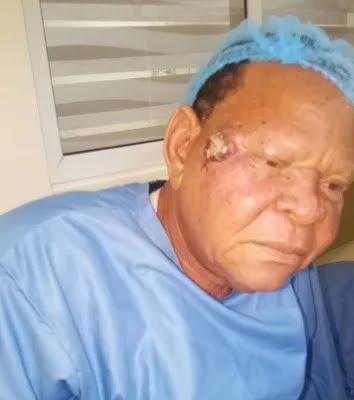 Baba Elesho undergoes surgery, dismisses cancer speculations