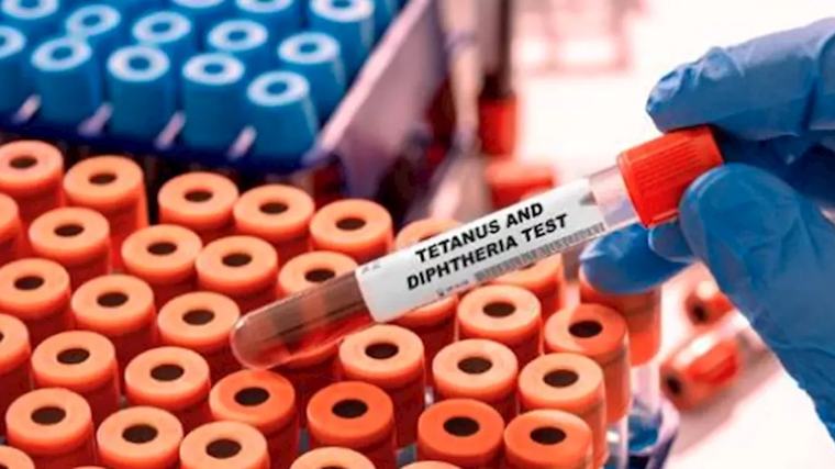 NCDC: Eight States Account for 98% of Diphtheria Cases in Nigeria